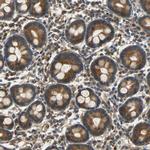 C1orf198 Antibody in Immunohistochemistry (Paraffin) (IHC (P))