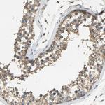 C1orf198 Antibody in Immunohistochemistry (Paraffin) (IHC (P))