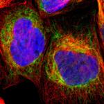 TOMM6 Polyclonal Antibody