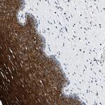 TOMM6 Antibody in Immunohistochemistry (Paraffin) (IHC (P))