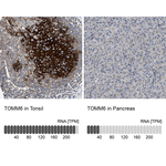 TOMM6 Antibody in Immunohistochemistry (Paraffin) (IHC (P))