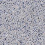 TOMM6 Antibody in Immunohistochemistry (Paraffin) (IHC (P))