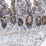 TOMM6 Antibody in Immunohistochemistry (Paraffin) (IHC (P))