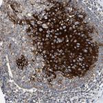TOMM6 Antibody in Immunohistochemistry (Paraffin) (IHC (P))