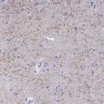 LAMP5 Polyclonal Antibody