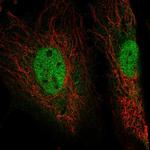 EYA4 Polyclonal Antibody