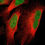 Vezatin Polyclonal Antibody