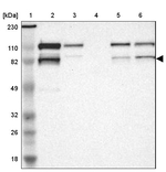 Vezatin Antibody in Western Blot (WB)