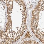 Vezatin Antibody in Immunohistochemistry (IHC)