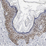 GRHL2 Polyclonal Antibody