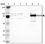 H6PD Antibody in Western Blot (WB)