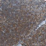 p41-ARCb Antibody in Immunohistochemistry (Paraffin) (IHC (P))