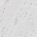 p41-ARCb Antibody in Immunohistochemistry (Paraffin) (IHC (P))