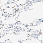 p41-ARCb Antibody in Immunohistochemistry (Paraffin) (IHC (P))
