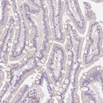 HRC Polyclonal Antibody