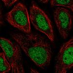 GTF2H3 Polyclonal Antibody