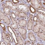 GTF2H3 Antibody in Immunohistochemistry (Paraffin) (IHC (P))