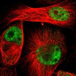 ZMAT5 Polyclonal Antibody