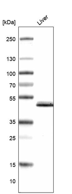 GALT Antibody in Western Blot (WB)