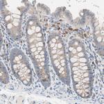 CLEC4D Antibody in Immunohistochemistry (Paraffin) (IHC (P))
