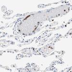 CLEC4D Antibody in Immunohistochemistry (Paraffin) (IHC (P))