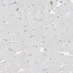 CLEC4D Antibody in Immunohistochemistry (Paraffin) (IHC (P))