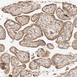 PTPN22 Polyclonal Antibody