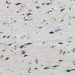 DIAPH1 Antibody in Immunohistochemistry (Paraffin) (IHC (P))