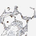 DIAPH1 Antibody in Immunohistochemistry (Paraffin) (IHC (P))