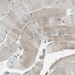 DIAPH1 Antibody in Immunohistochemistry (Paraffin) (IHC (P))