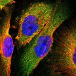 TSC22D2 Polyclonal Antibody