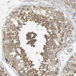 TSC22D2 Antibody in Immunohistochemistry (Paraffin) (IHC (P))