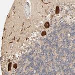 CLEC4E Polyclonal Antibody