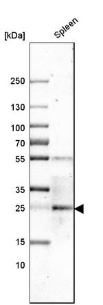 CLEC4E Antibody in Western Blot (WB)
