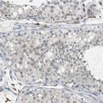 PTGDS Polyclonal Antibody