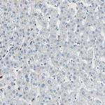 PTGDS Antibody in Immunohistochemistry (IHC)