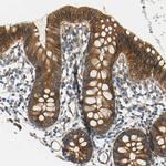 KIAA1217 Antibody in Immunohistochemistry (Paraffin) (IHC (P))