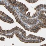 KIAA1217 Antibody in Immunohistochemistry (Paraffin) (IHC (P))