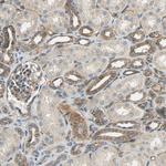 KIAA1217 Antibody in Immunohistochemistry (Paraffin) (IHC (P))