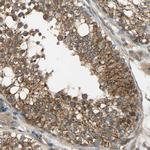 KIAA1217 Antibody in Immunohistochemistry (Paraffin) (IHC (P))