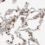 Stabilin 1 Antibody in Immunohistochemistry (Paraffin) (IHC (P))