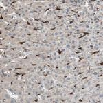 Stabilin 1 Antibody in Immunohistochemistry (Paraffin) (IHC (P))