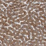 CC2D1A Polyclonal Antibody