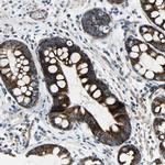 CHI3L2 Polyclonal Antibody