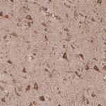 SEC31A Antibody in Immunohistochemistry (IHC)