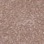 SEC31A Antibody in Immunohistochemistry (IHC)