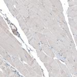 SEC31A Antibody in Immunohistochemistry (IHC)