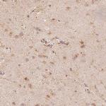 FMNL2 Antibody in Immunohistochemistry (IHC)