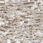 ASAH1 Antibody in Immunohistochemistry (IHC)