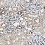 ASAH1 Polyclonal Antibody